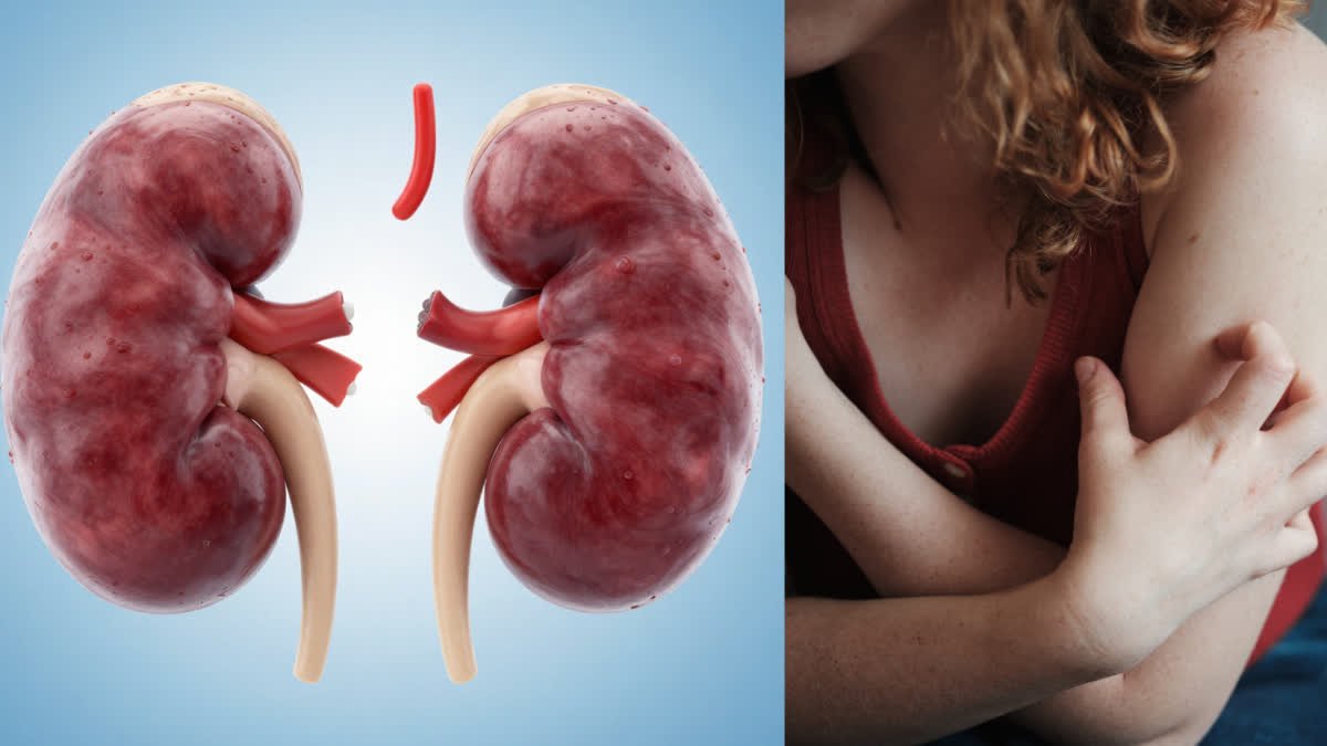 1200-675-27233632-thumbnail-16x9-kidney.jpg